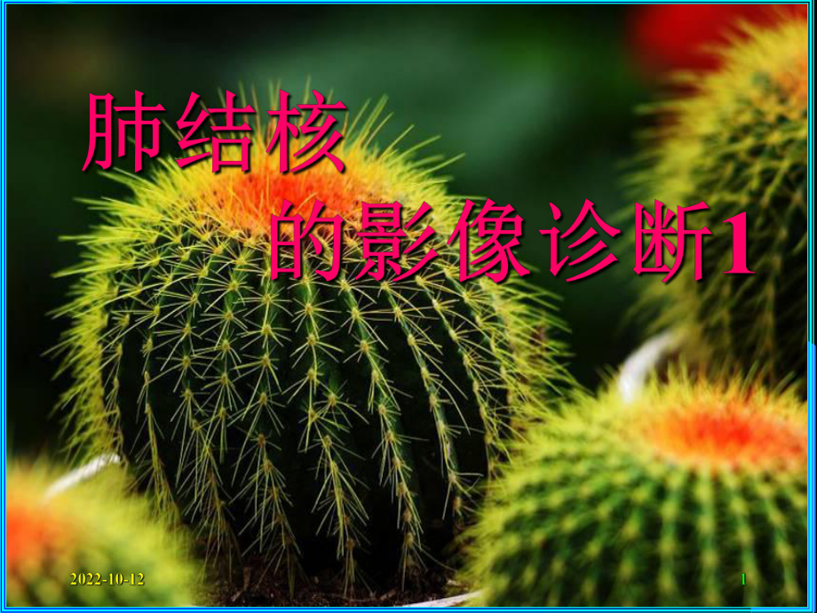 肺结核的CT诊断1课件.ppt_第1页