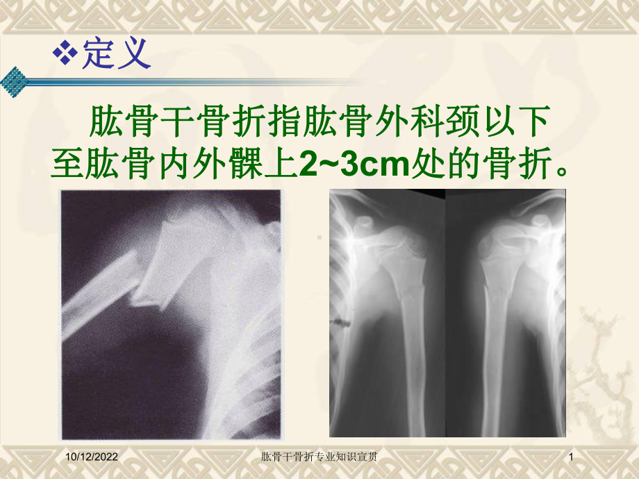 肱骨干骨折专业知识宣贯培训课件.ppt_第1页