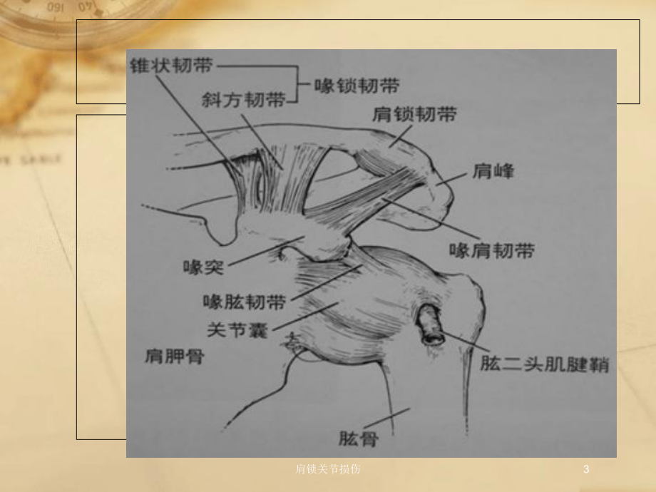 肩锁关节损伤培训课件.ppt_第3页