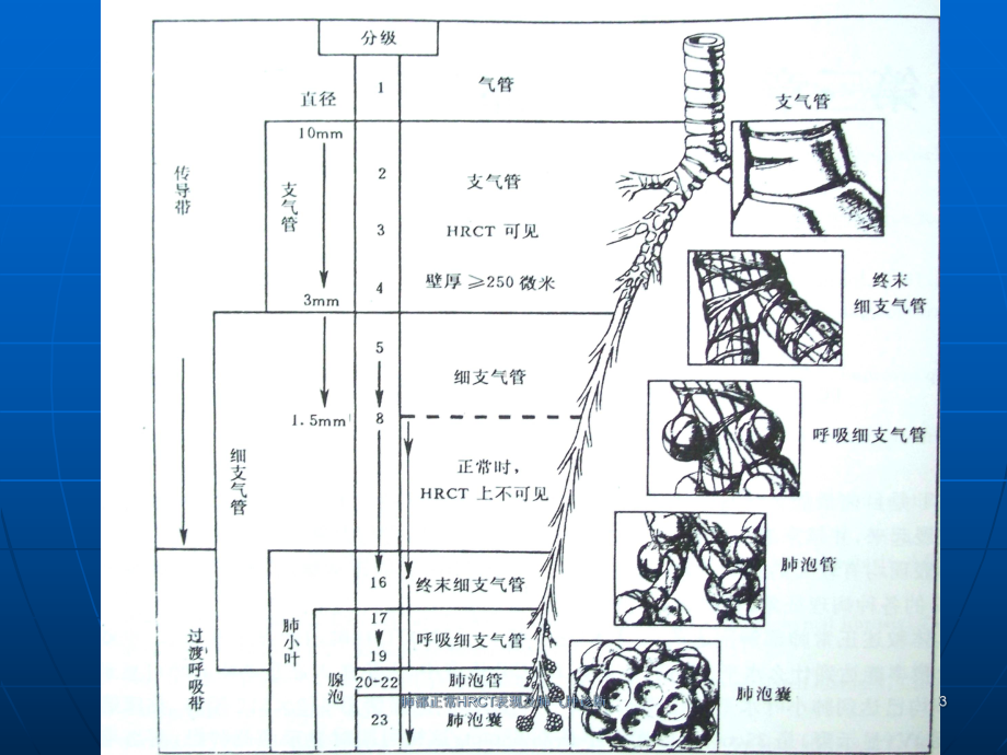 肺部正常HRCT表现及肺气肿诊断课件.ppt_第3页