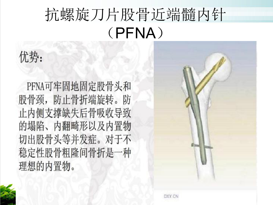 股骨粗隆间骨折手术配合培训课程课件.ppt_第3页