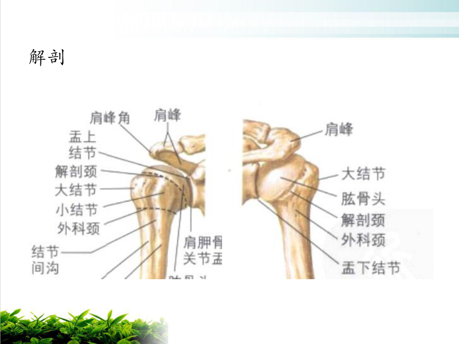 肱骨近端骨折教案讲课课件.ppt_第2页