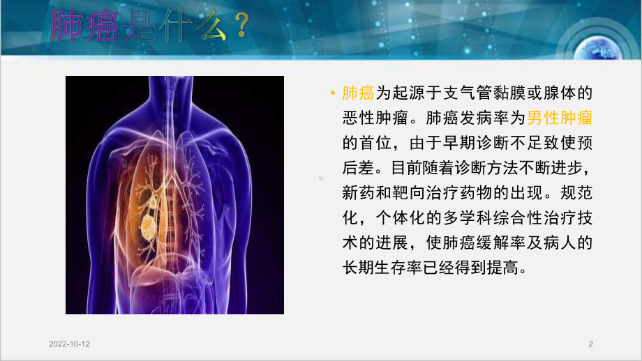 肺癌化疗护理的业务学习参考课件.ppt_第2页