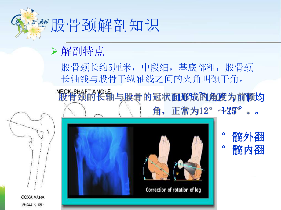 股骨颈骨折的护理课件.pptx_第3页