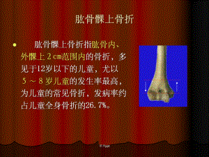 肱骨髁上骨折67876课件.ppt