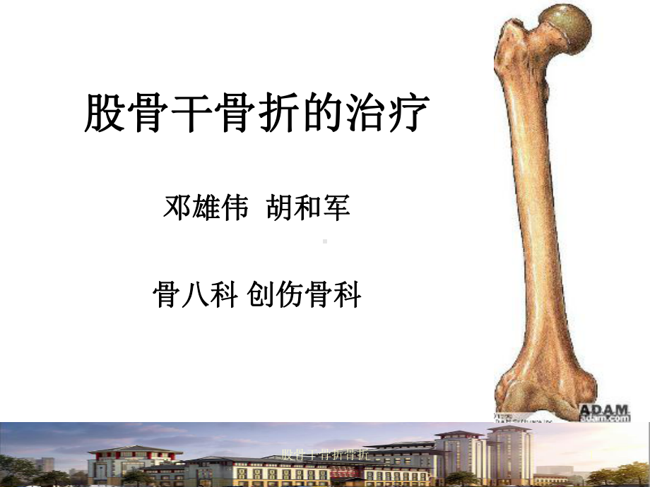 股骨干骨折骨折课件.ppt_第1页