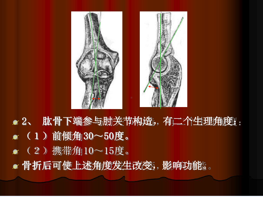 肱骨髁上骨折介绍课件.ppt_第3页