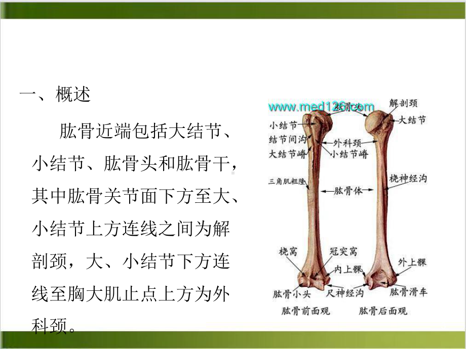 肱骨近端骨折业务查房优质案例课件.ppt_第3页