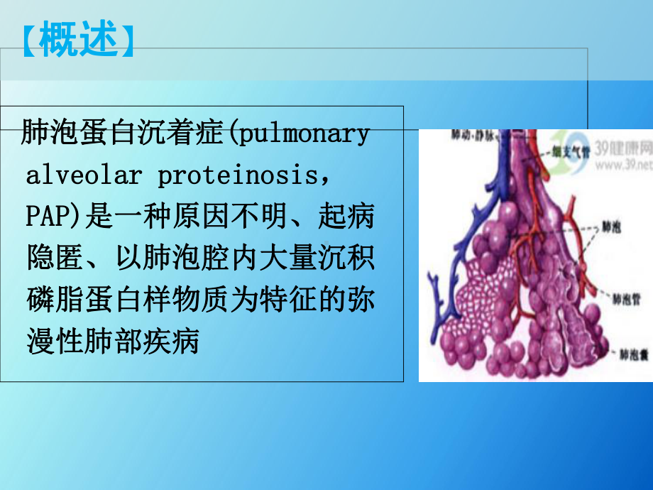 肺泡蛋白沉着症影像表现课件.ppt_第3页