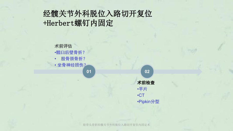 股骨头骨折经髋关节外科脱位入路切开复位内固定术课件.ppt_第3页