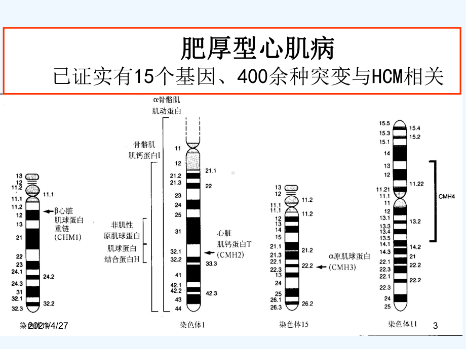 肥厚型心肌病的诊断与治疗课件.ppt_第3页