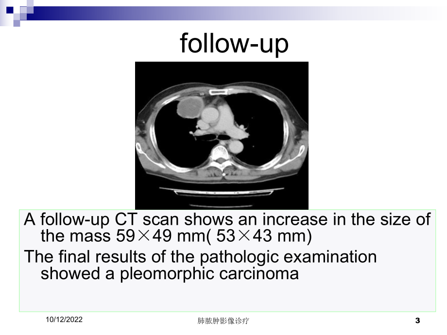 肺脓肿影像诊疗培训课件.ppt_第3页