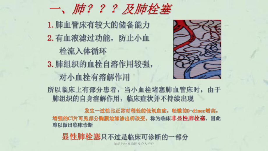 肺动脉栓塞诊断及介入治疗课件.ppt_第3页