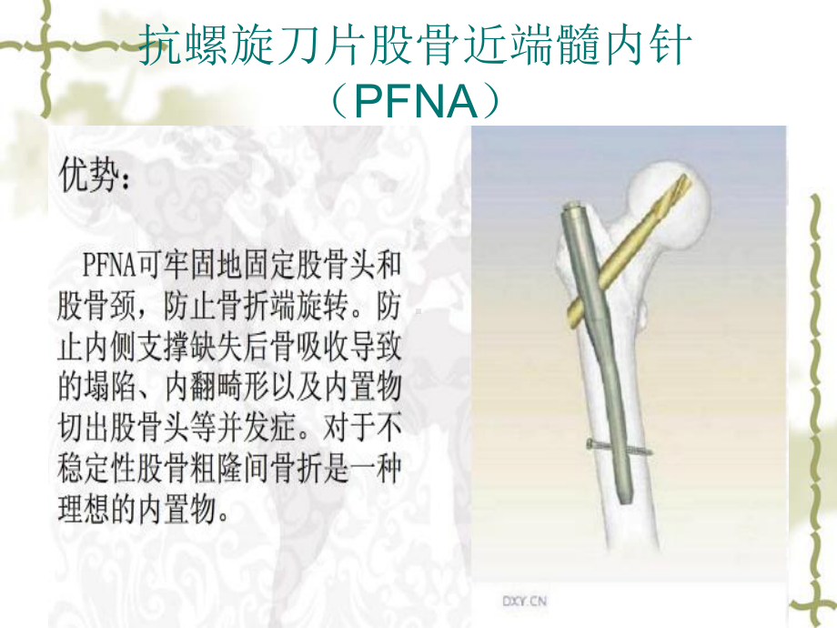 股骨粗隆间骨折手术配合(课件).ppt_第2页