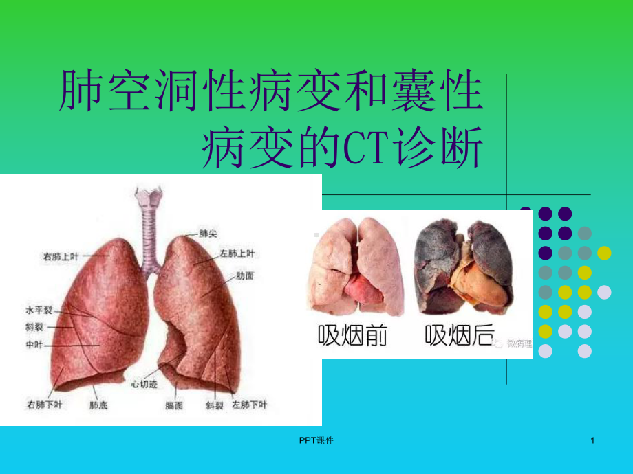 肺空洞性病变和囊性病变的CT诊断-课件.ppt_第1页