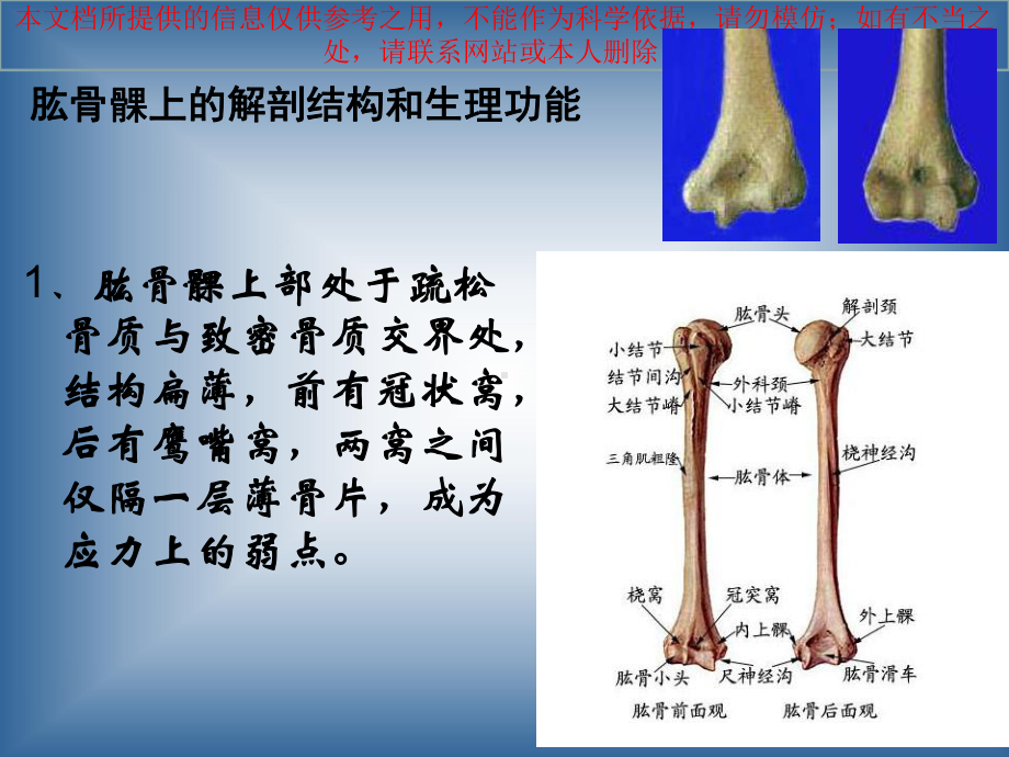 肱骨髁上骨折讲解自制完整版培训课件.ppt_第2页