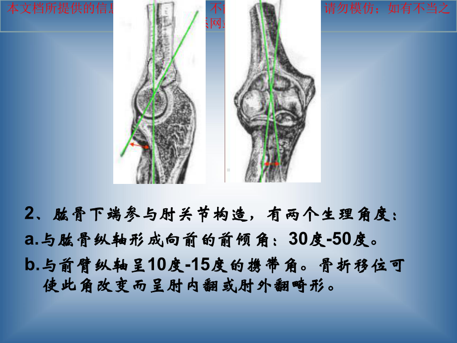 肱骨髁上骨折讲解自制完整版培训课件.ppt_第3页