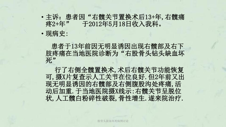 股骨头缺血坏死病例讨论课件.ppt_第3页