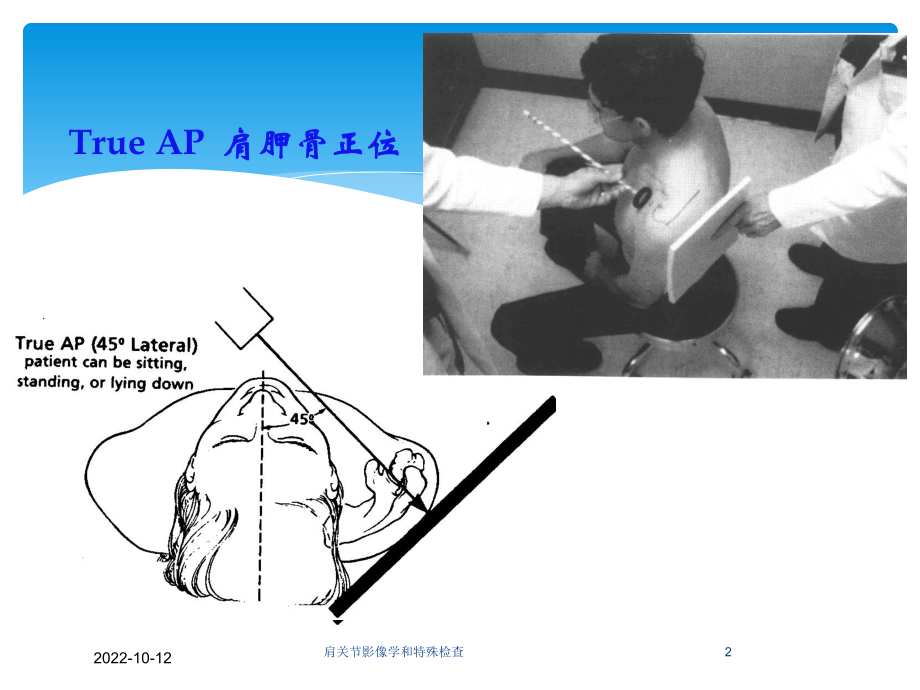 肩关节影像学和特殊检查培训课件.ppt_第2页