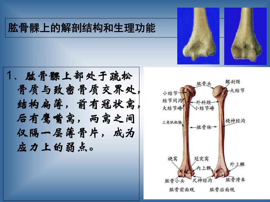 肱骨髁上骨折讲解自制完整版培训课件-2.ppt_第3页