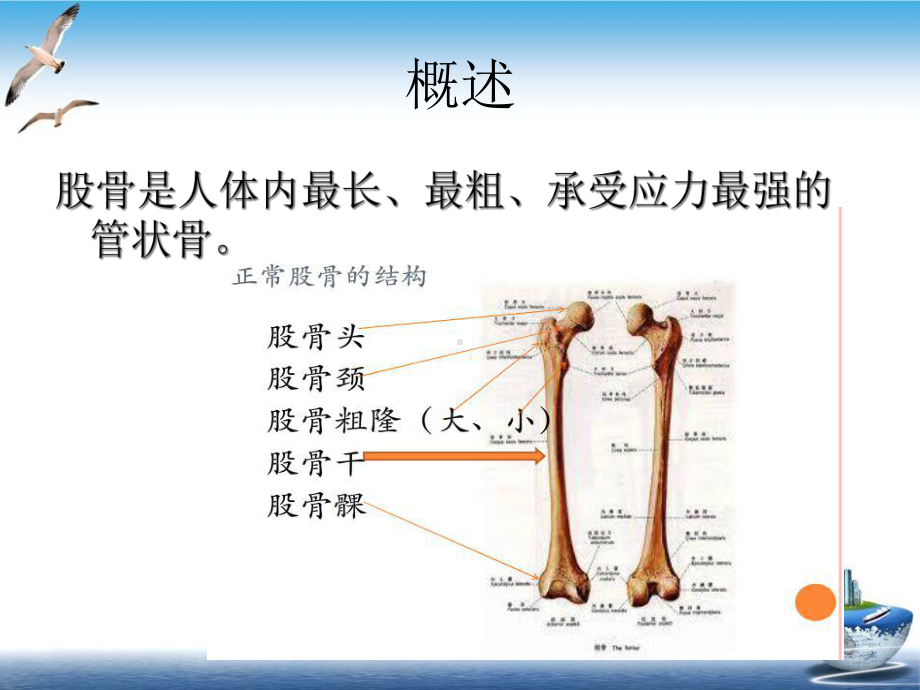 股骨骨折的健康宣教课件.ppt_第2页