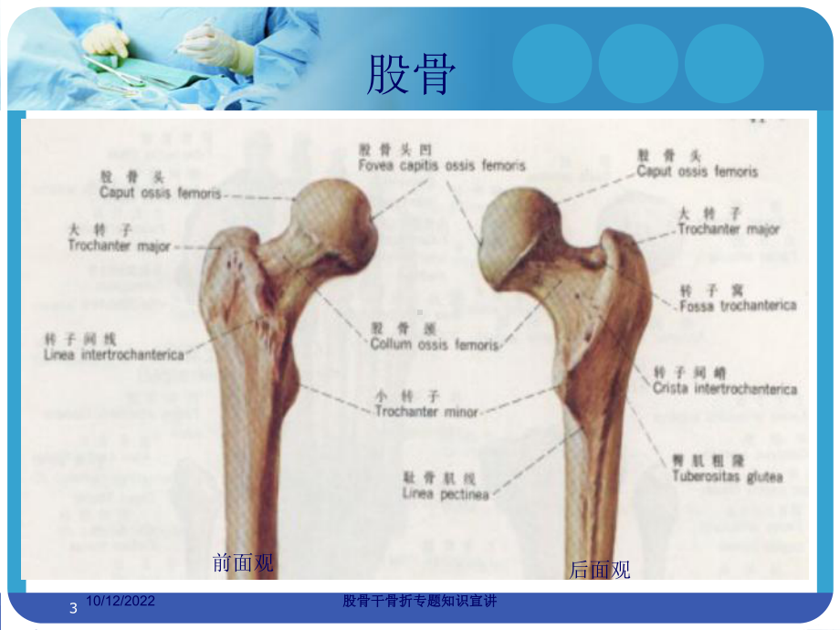 股骨干骨折专题知识宣讲培训课件.ppt_第3页