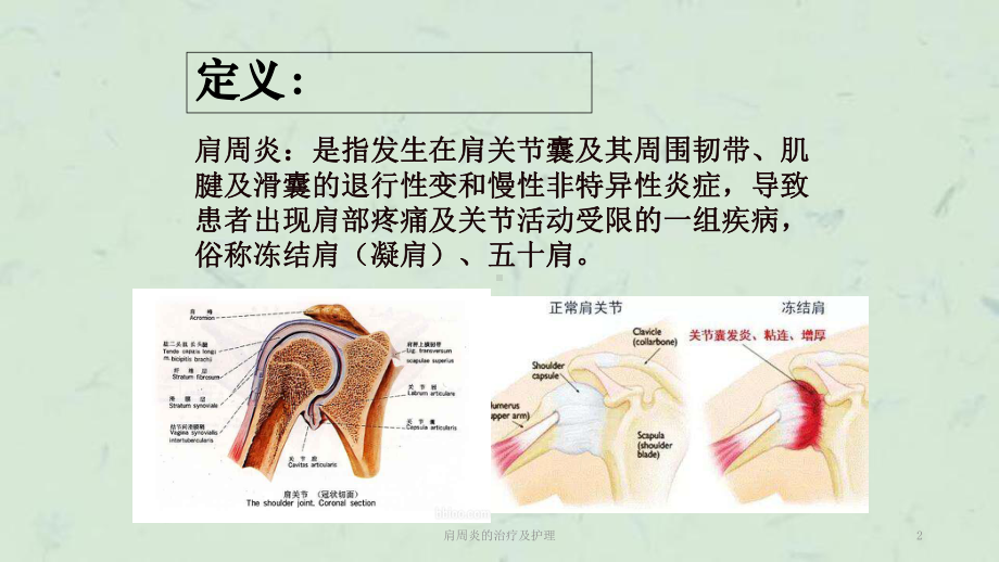 肩周炎的治疗及护理课件.ppt_第2页