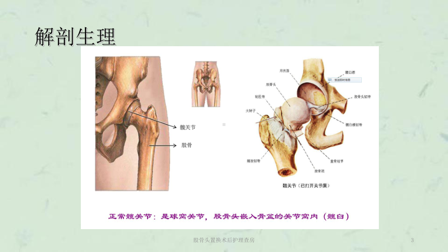 股骨头置换术后护理查房课件.ppt_第3页