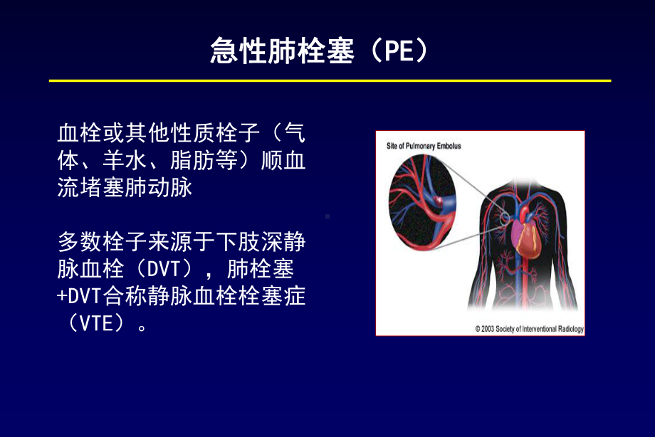 肺栓塞诊断及鉴别诊断课件.ppt_第2页