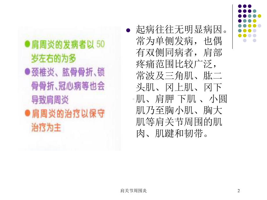 肩关节周围炎培训课件.ppt_第2页