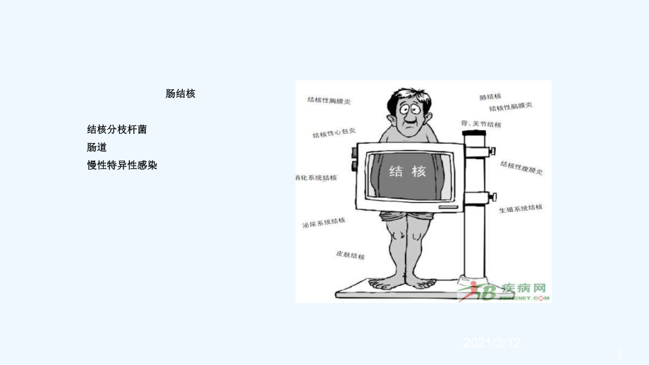 肠结核结核性腹膜炎课件.ppt_第3页