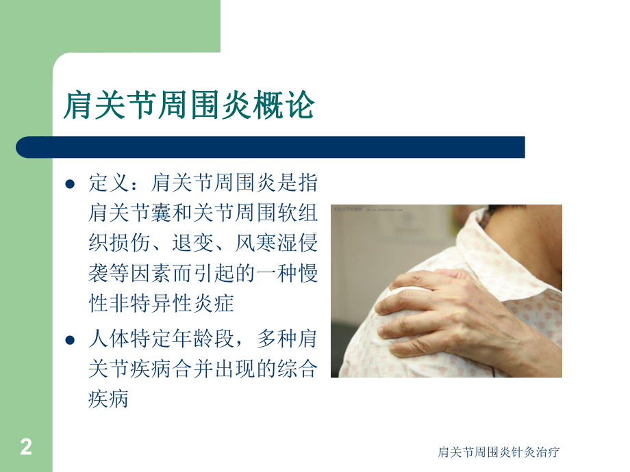 肩关节周围炎针灸治疗培训课件.ppt_第2页