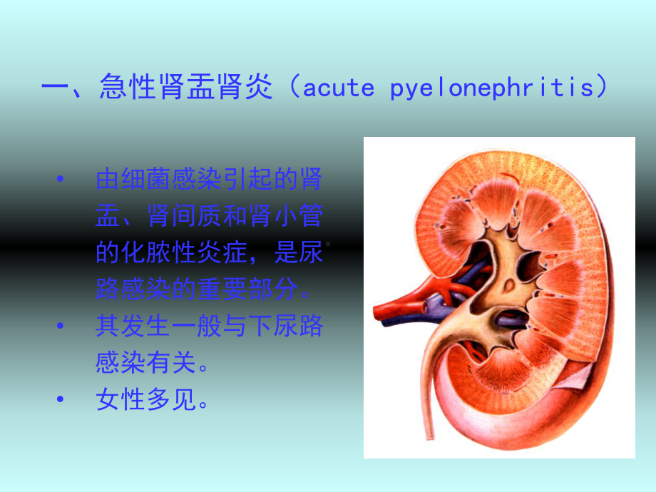 《肾盂肾炎肿瘤》课件.ppt_第2页