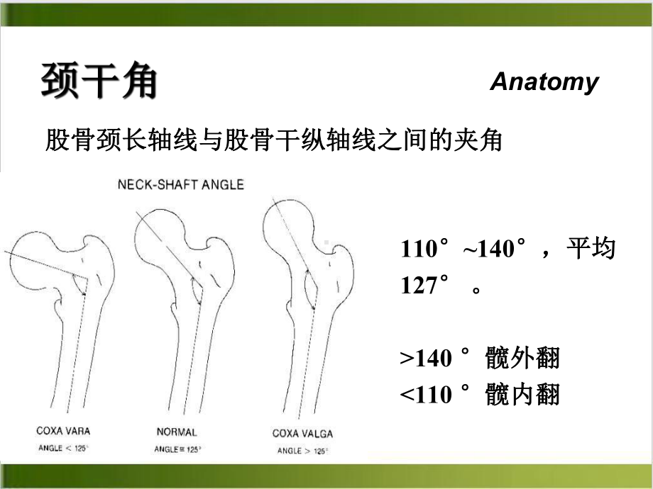 股骨颈骨折课件副本培训课程.ppt_第3页