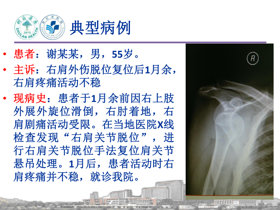 肩关节脱位合并盂唇Bankart损伤病例汇报课件.pptx_第2页