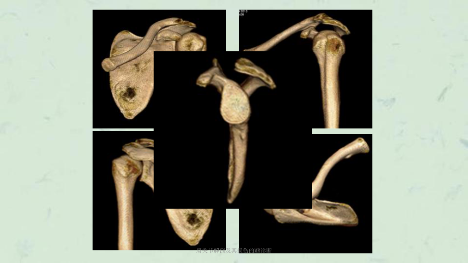 肩关节解剖及其损伤的MR诊断课件.ppt_第3页
