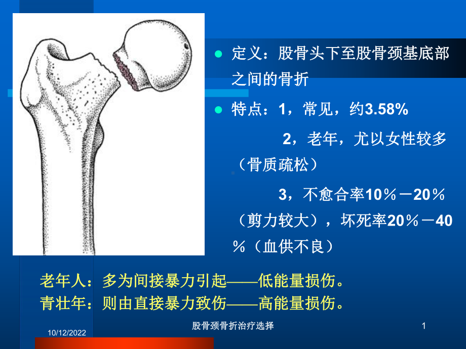 股骨颈骨折治疗选择培训课件.ppt_第1页