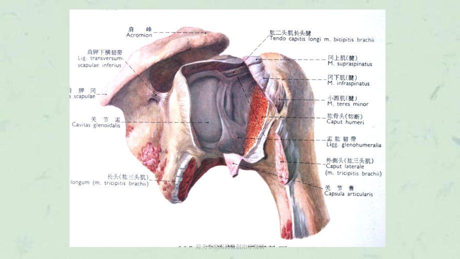 肩关节疾病的微创治疗现状课件.ppt_第3页