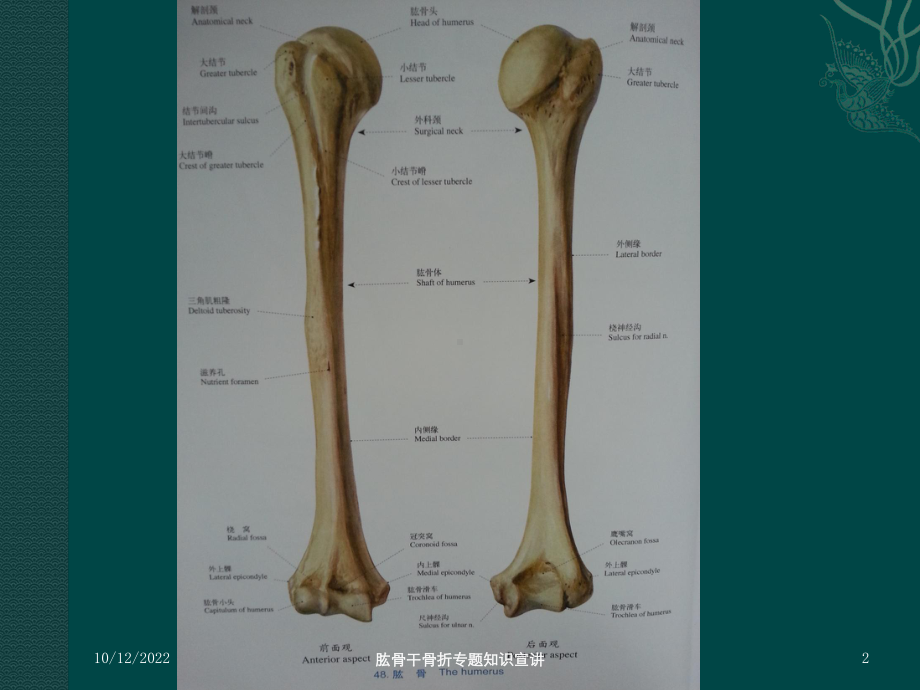 肱骨干骨折专题知识宣讲培训课件.ppt_第2页