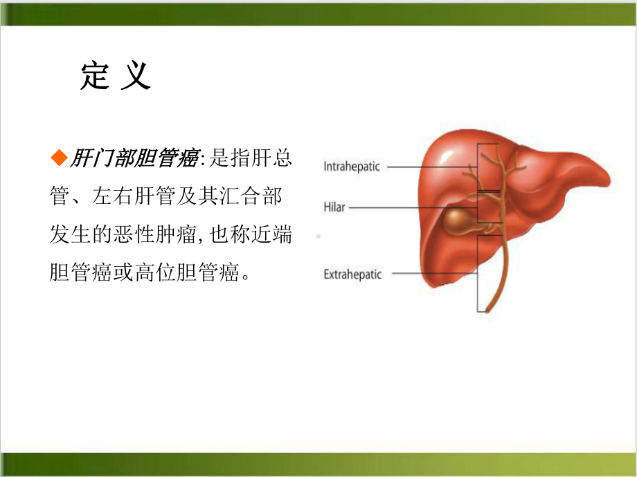 肝门部胆管癌的分型与手术策略课件1.ppt_第3页