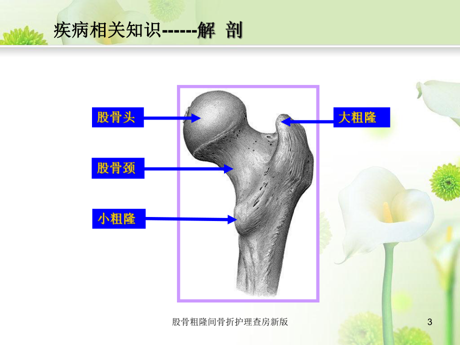 股骨粗隆间骨折护理查房新版培训课件.ppt_第3页