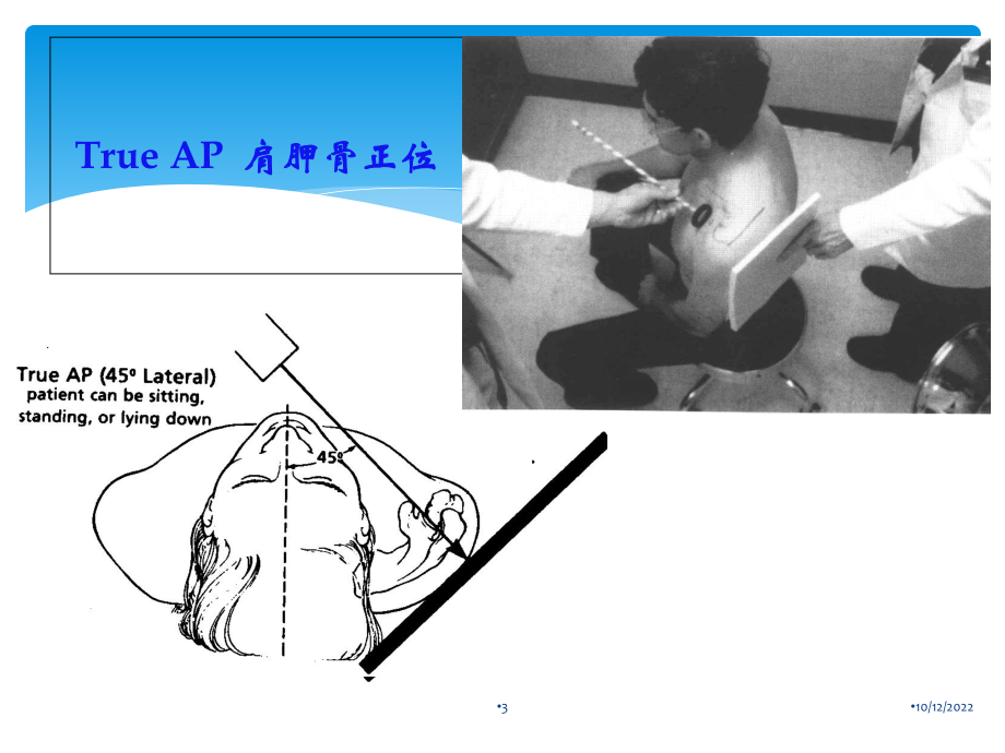 肩关节影像学及特殊检查医学课件.ppt_第3页