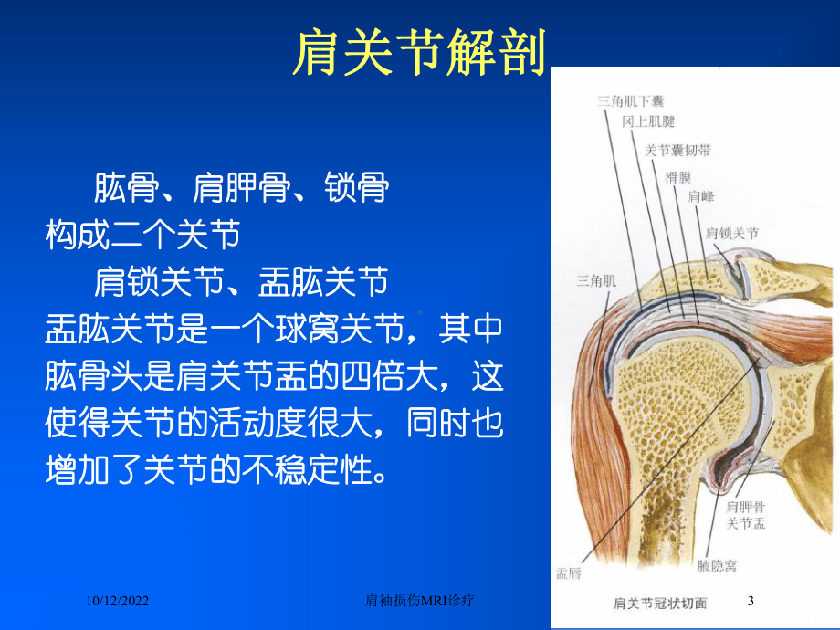 肩袖损伤MRI诊疗培训课件.ppt_第3页