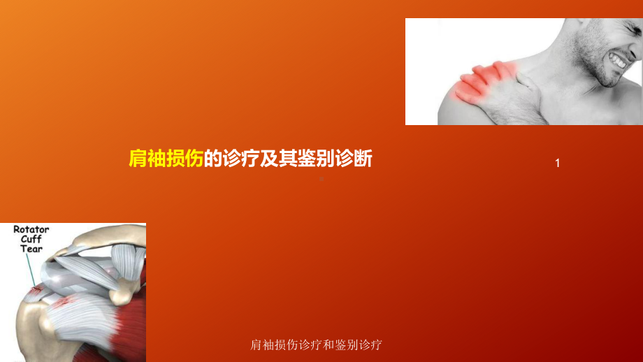 肩袖损伤诊疗和鉴别诊疗培训课件.ppt_第2页