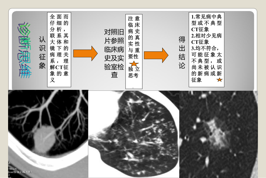 肺特殊CT征象完整版本课件.ppt_第3页