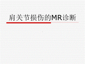 肩关节损伤的MR诊断课件-2.ppt