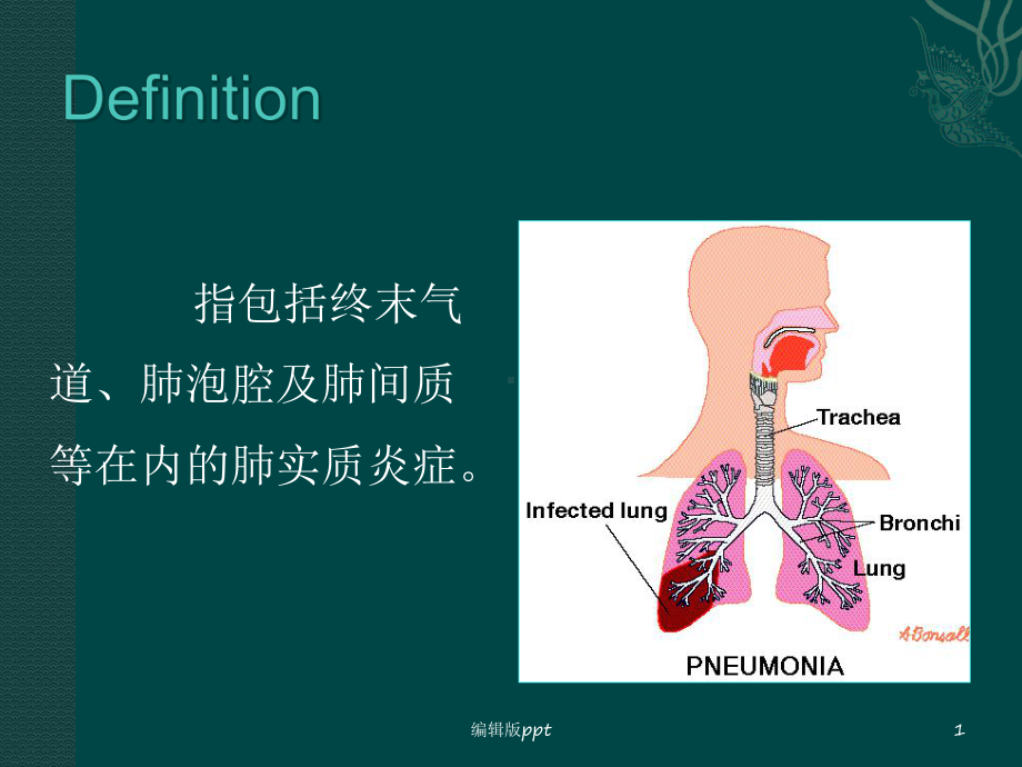 肺部感染性疾病医学课件.ppt_第1页