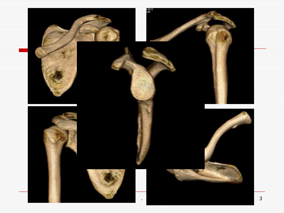 肩关节解剖及其损伤的MR诊断课件-2.ppt_第3页