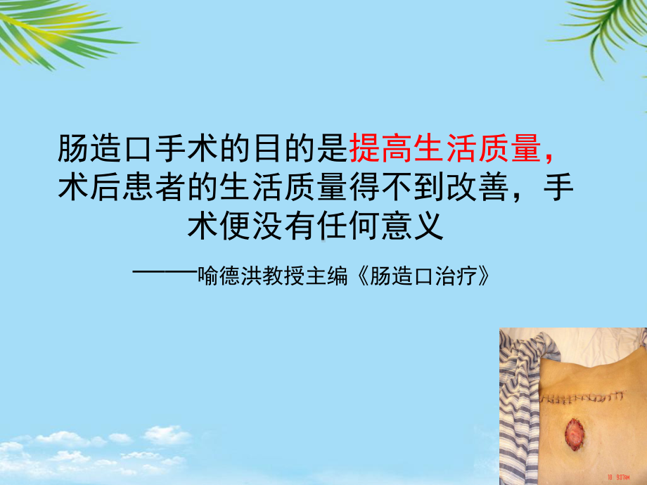 肠造口及其周围并发症最全课件.ppt_第3页