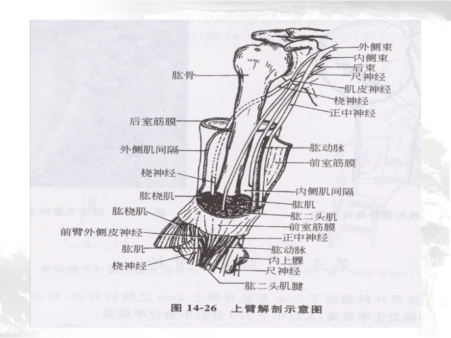 肱骨骨折护理查房邹娟课件.ppt_第2页